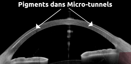 Microtunnels